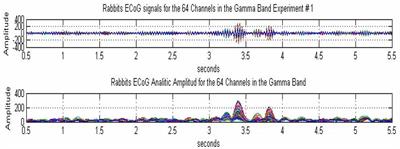 Cinematic Operation of the Cerebral Cortex Interpreted via Critical Transitions in Self-Organized Dynamic Systems